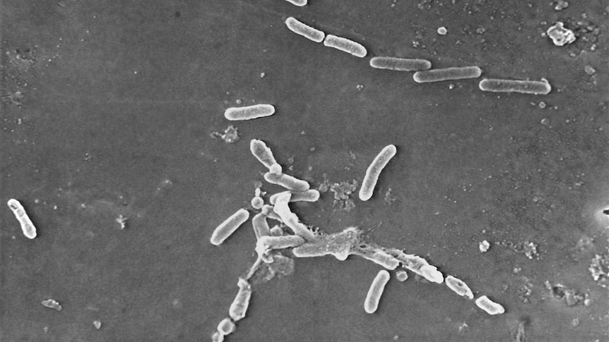 A black and white microscopic image of the Pseudomonas aeruginosa bacteria.