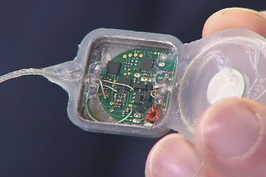 A close up of the inside of a Minder device which helps track epileptic seizures.
