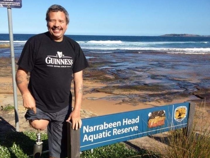 Kelvin pictured with a prosthetic leg at the ocean