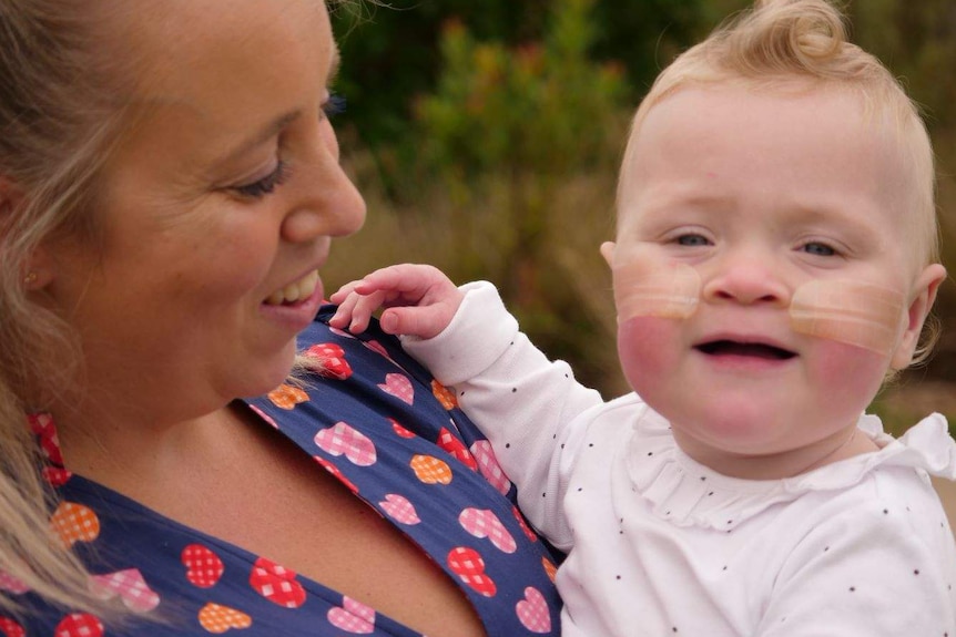 A woman holding a young girl who has tubes near her nose taped to her cheeks.