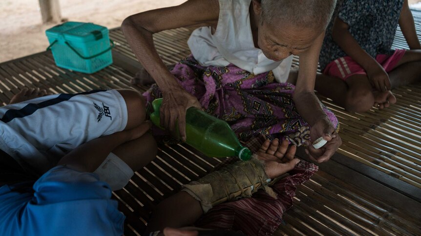 A woman tends to her grandson's broken arm using traditional medicine