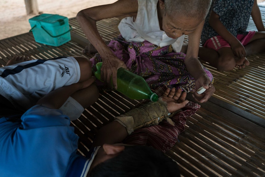 A woman tends to her grandson's broken arm using traditional medicine