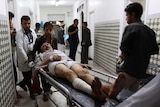 Man injured in Yemen suicide bombings