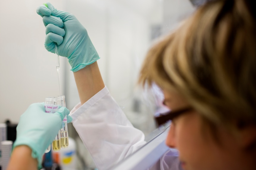 A technician prepares an urine sample to test for doping