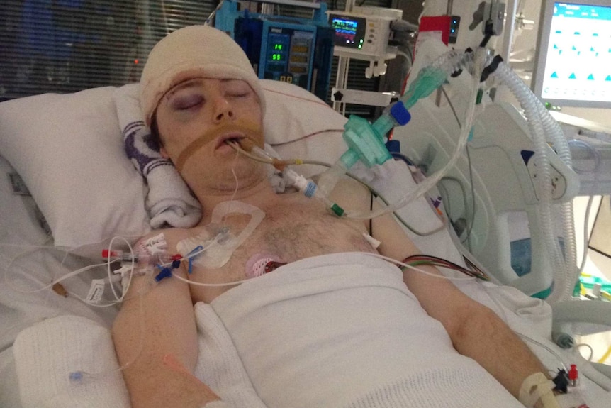 Dieter Horvat laying in a hospital bed in the ICU after being hit by a car