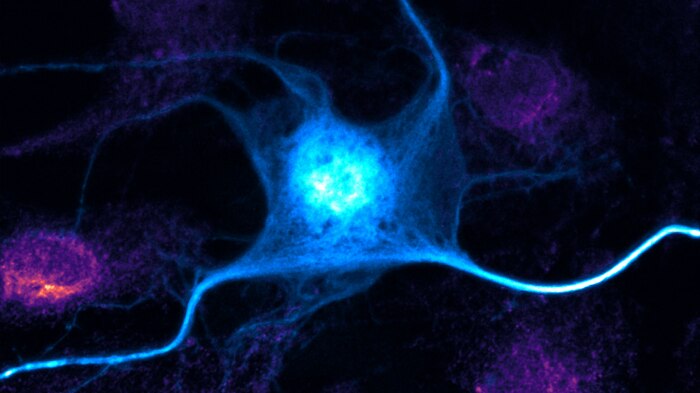 An image showing a neuro expressing a protein.