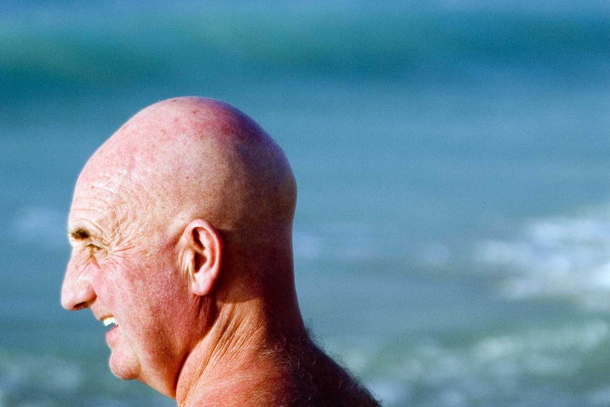 A bald man.