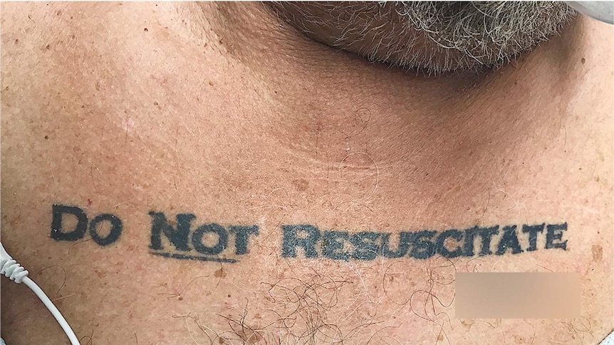 The 70-year-old patient's "Do not resuscitate" tattoo printed in large, black letters across his chest.