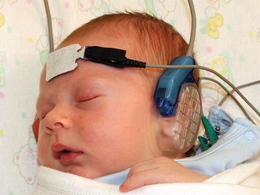 A time baby sleeps with chords and contraptions attached to its head. 