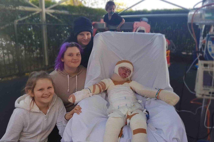 Burns victim Cody on a hospital bed wrapped in full body bandages and surrounded by family