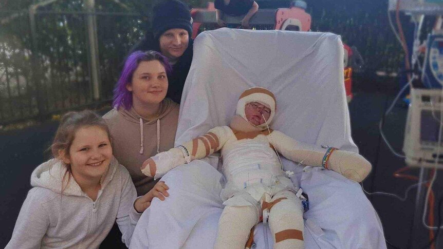 Burns victim Cody on a hospital bed wrapped in full body bandages and surrounded by family
