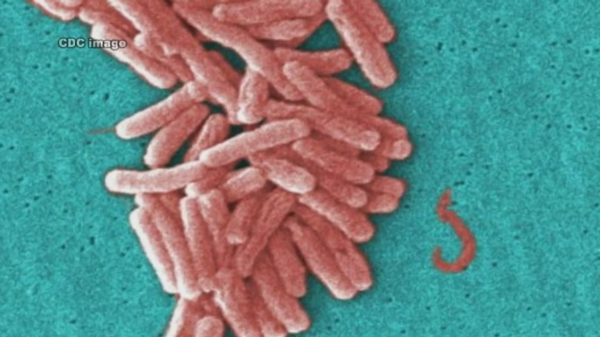 Legionella bacteria