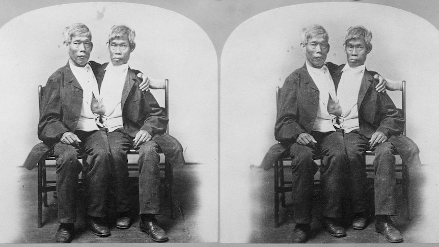 Scans of two men conjoined sitting in a chair 