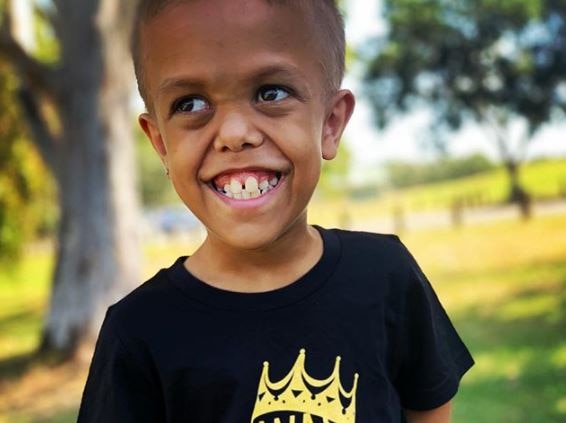 A young boy with dwarfism crosses his arms and stares into the camera with a tough expression on his face