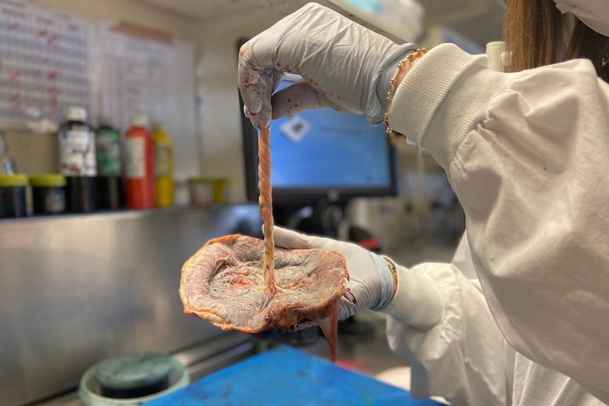 A placenta, looking dry and preserved, is held up in Jane's hand in a lab.