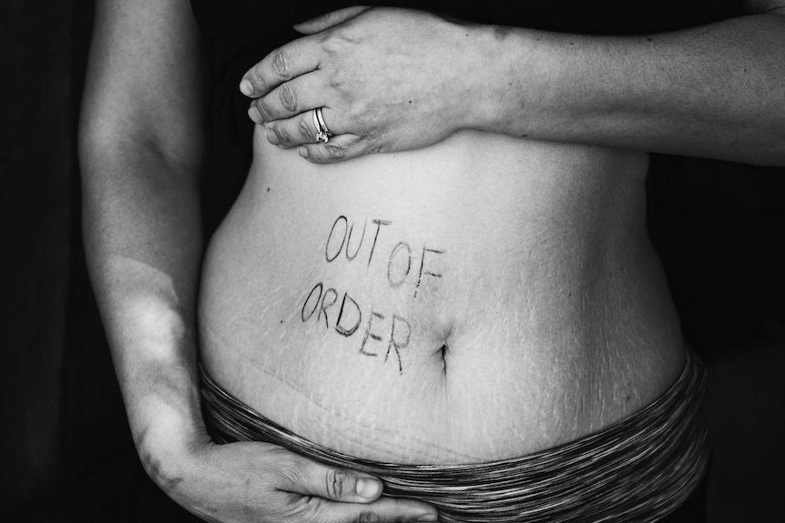 A black and white photo of a woman's stomach with the words 'out of order' written in pen on it