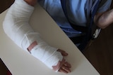 A woman's arm wrapped in bandages rests on a table.