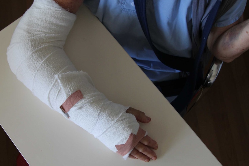 A woman's arm wrapped in bandages rests on a table.
