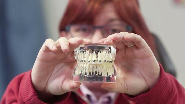 Hands hold model of teeth with braces