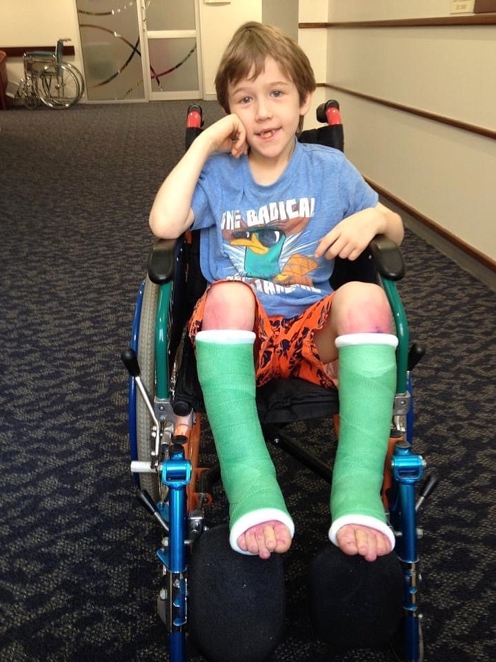 A young boy in a wheelchair with plaster casts on his lower legs