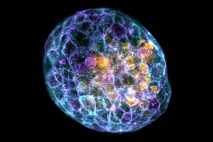 A blastoid or embryoid