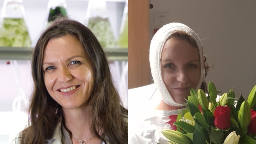 Left: A smiling woman with long hair in a lab coat. Right: The same woman has her head bandaged in hospital