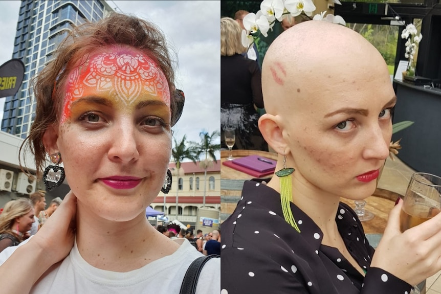Lucy Sweeney before and after her head shave