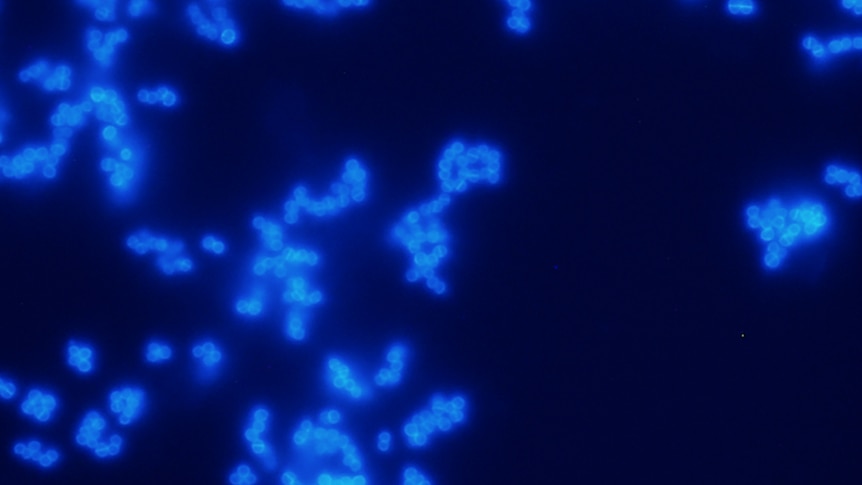 A superbug under a microscope