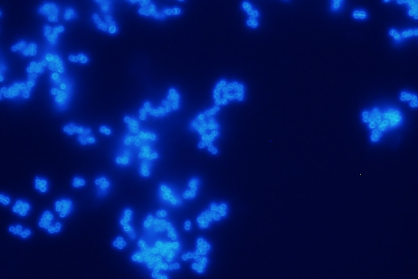 A superbug under a microscope