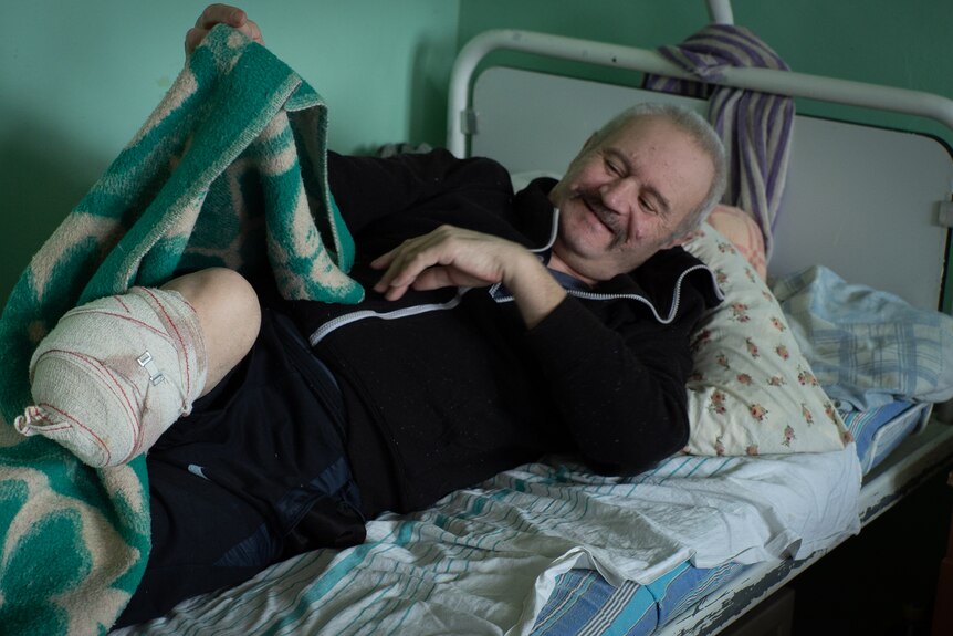 A man lifts his blanket and shows the bandages of his amputated leg