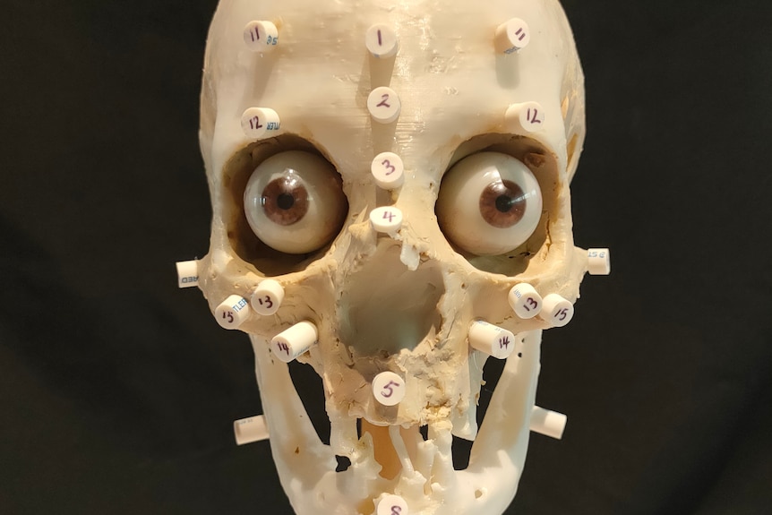 A skull with realistic brown eyes and numbered markers