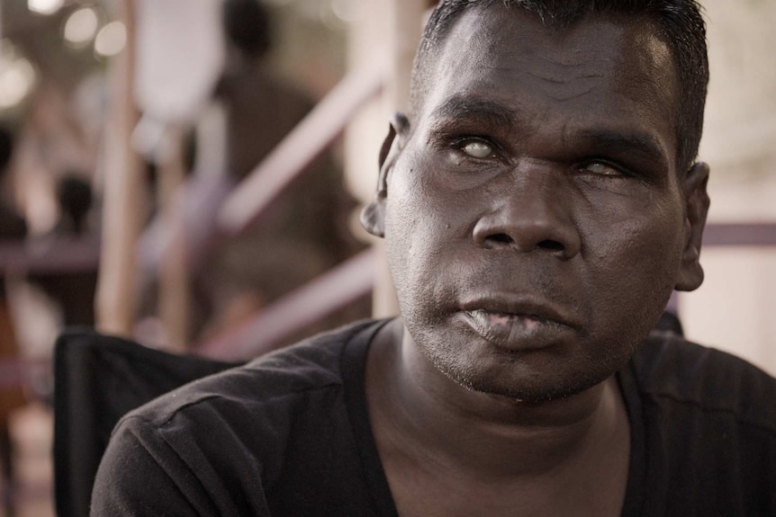 Gurrumul Yunupingu.