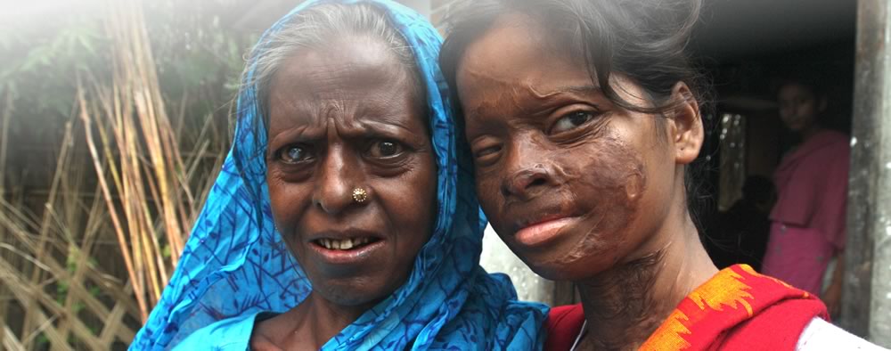 Hasina Akter and her mother