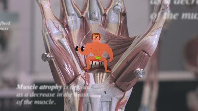 Anatomic model of hand shows muscles and tendons, little computer drawing of man lifting weights on top