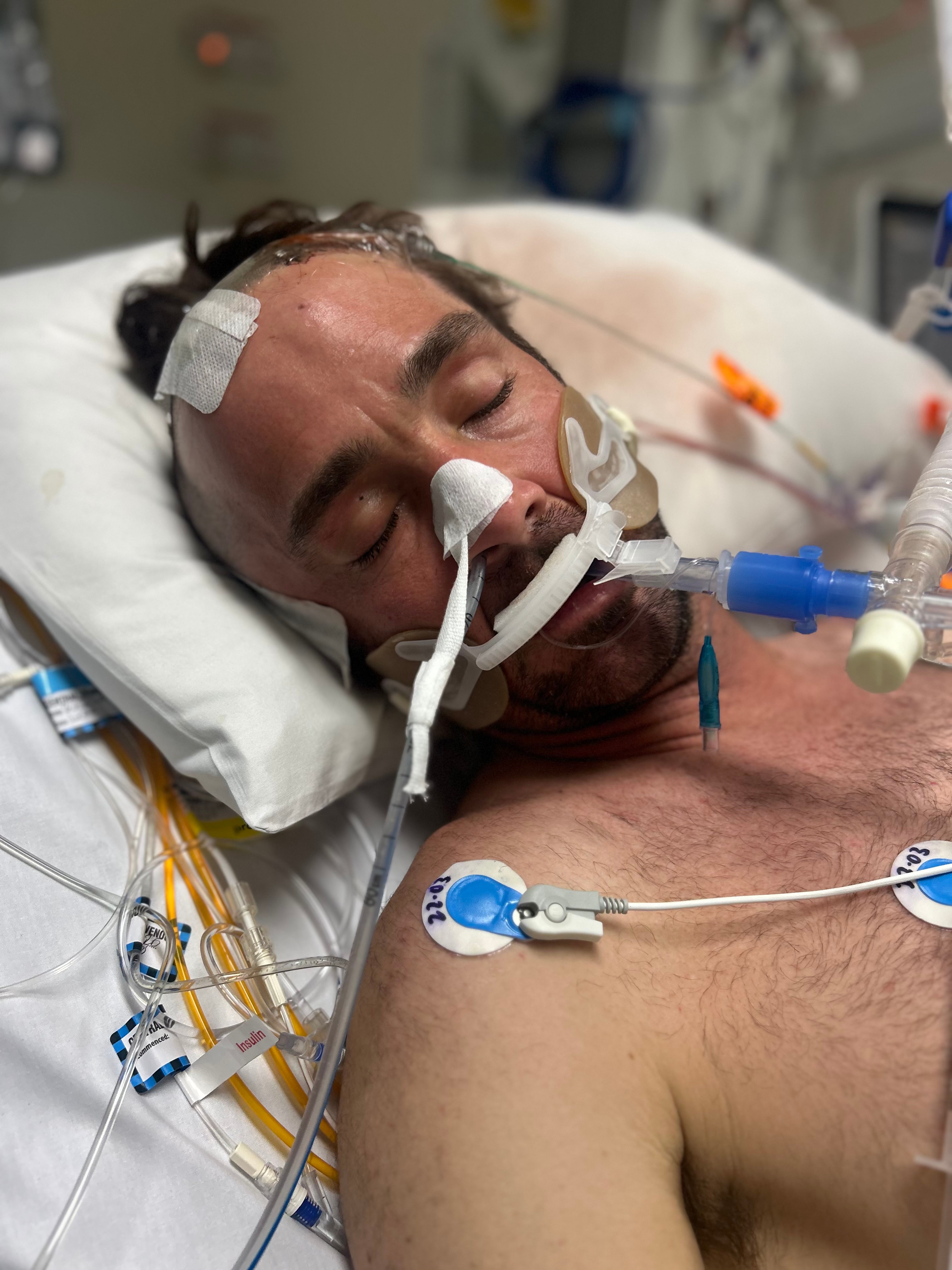 Former Olympic coach left with ongoing damage after 36-hour hospital ordeal