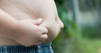 An overweight child holds his hands to his stomach