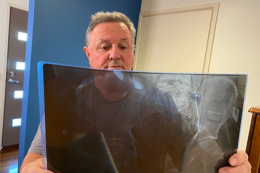An older man looking at an x-ray