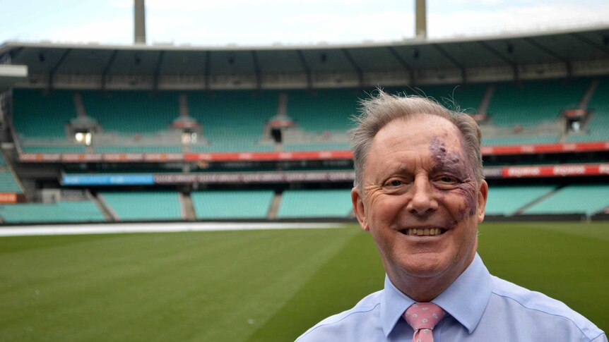 Anthony Dowell asked Curious Sydney what happened to the historic scoreboard at the SCG.