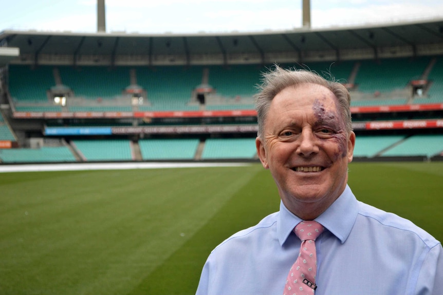 Anthony Dowell asked Curious Sydney what happened to the historic scoreboard at the SCG.
