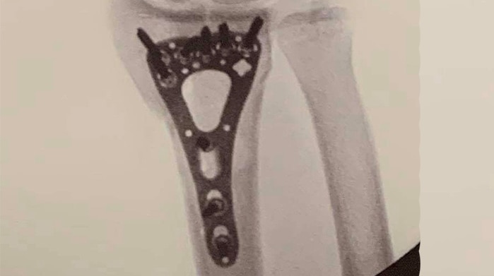 Composite image showing x-rays.