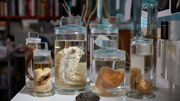 Specimens in a jar on a table.