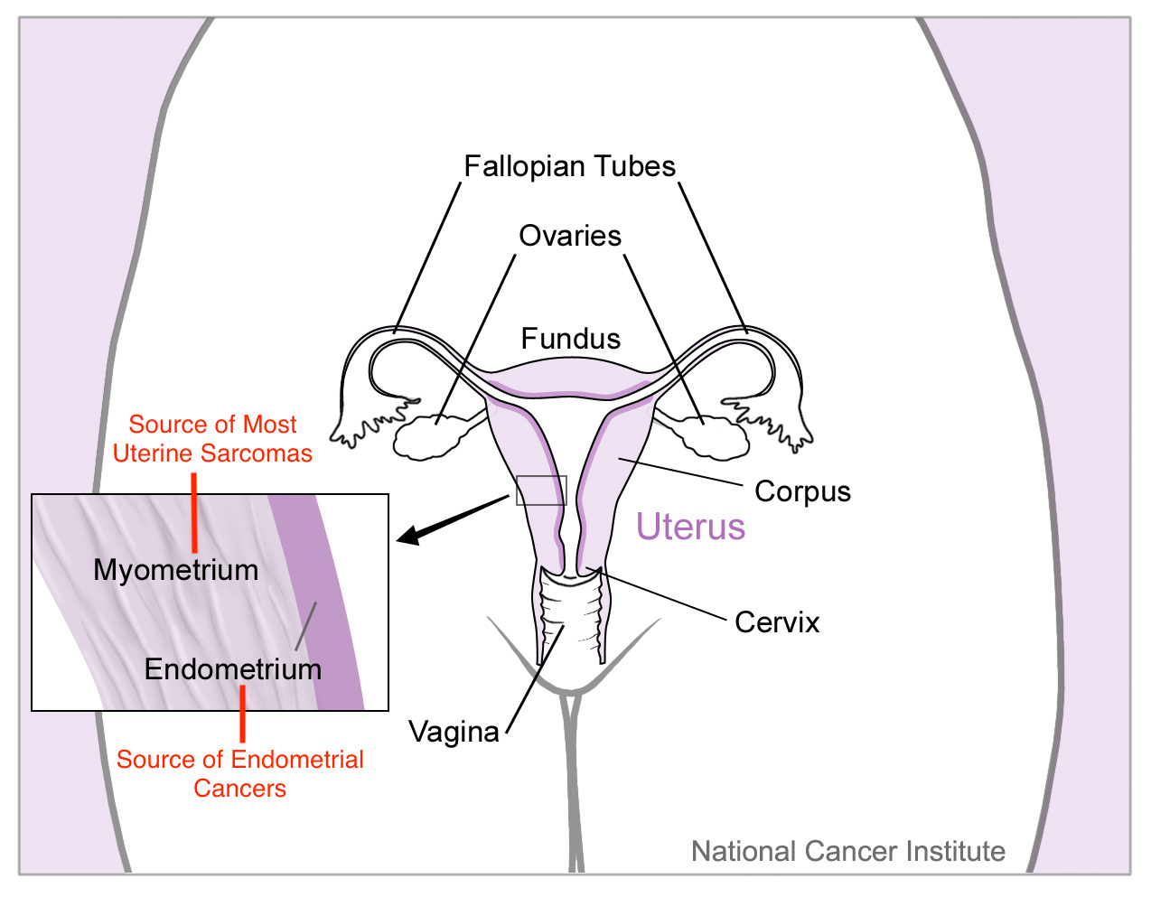 A diagram of the uterus.