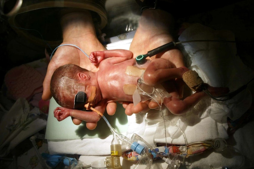 Premature baby Sophie Snowdon is held by her mother Meredith in the Women's Hospital in Adelaide