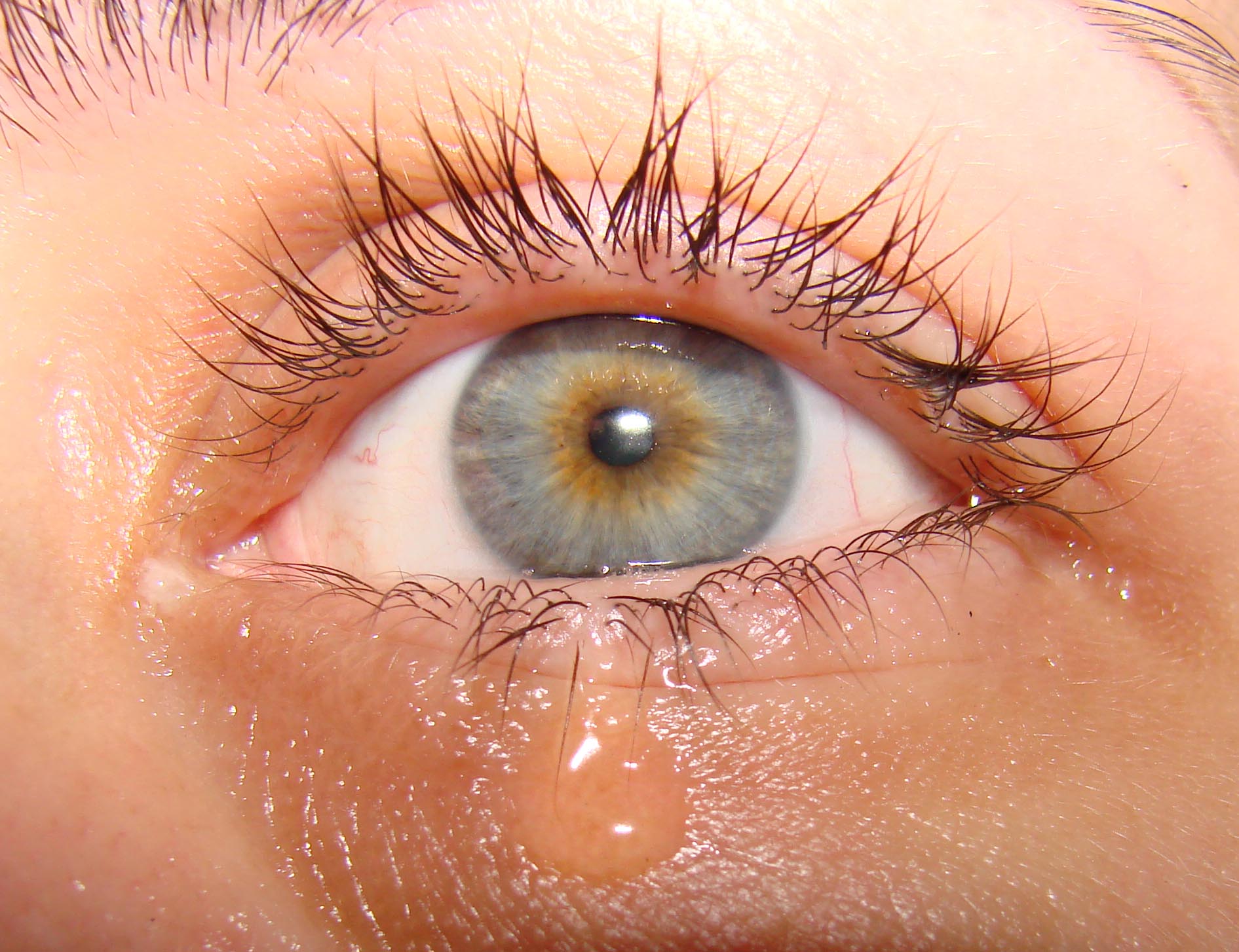 Dry Eye Explained: Why Winter And A Cold Breeze Can Make You Tear Up ...