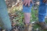 Man's calf showing long scar from mountain bike injury.