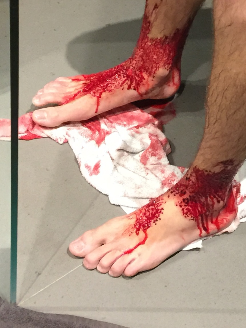 Blood on Sam Kanizay's legs after he was apparently bitten by small marine creatures.