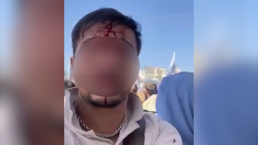 'I am an Australian citizen': Video surfaces of bloodied Hazara man in Afghanistan