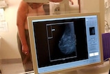 Woman stands topless at x-rays machine