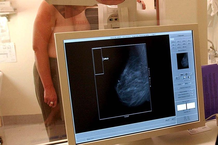 A woman having a mammogram behind a computer screen showing the process