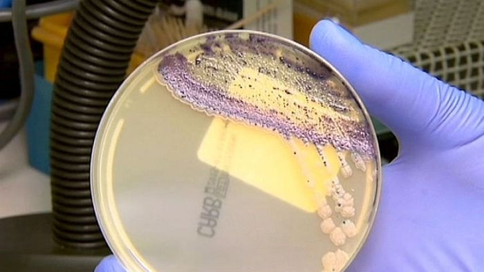 A petri dish with bacteria growing in it